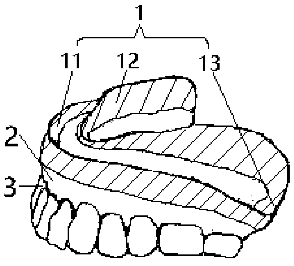 A kind of complete denture and preparation method thereof