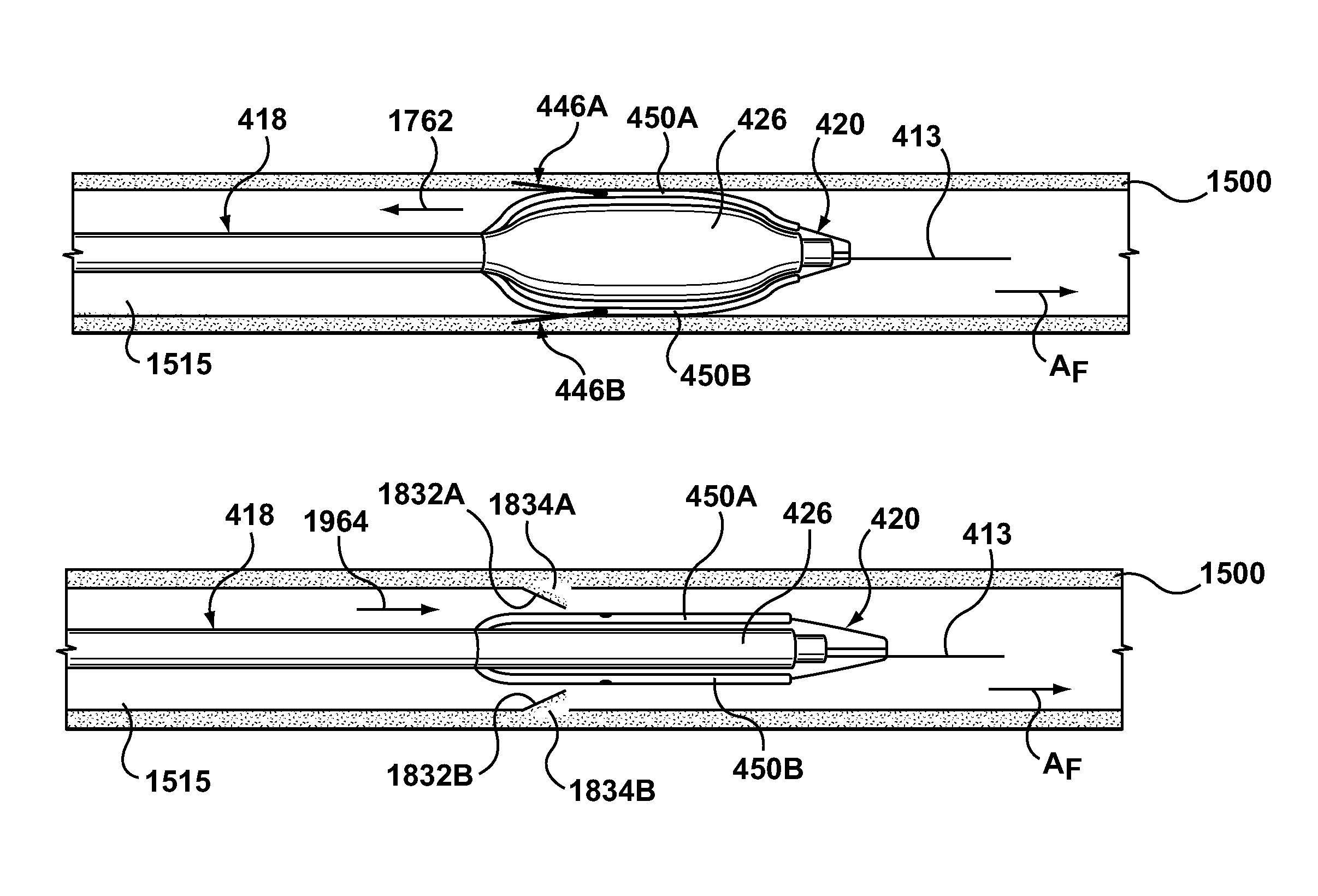 Percutaneous methods for apparatus for creating native tissue venous valves