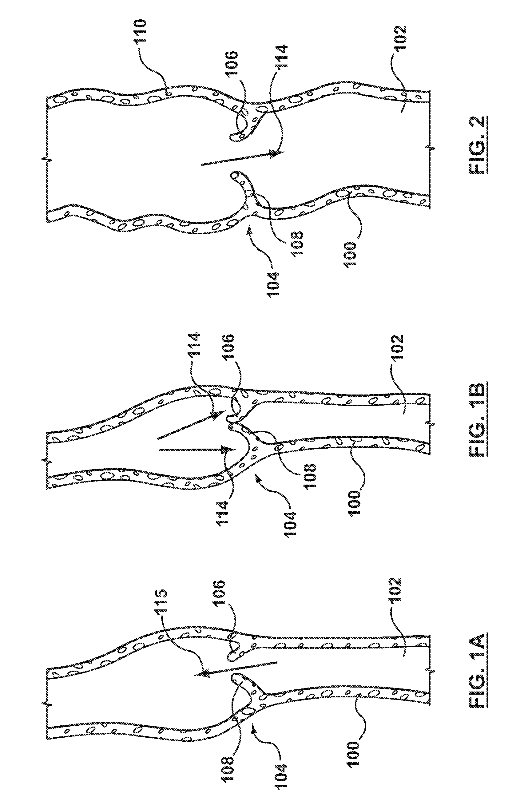 Percutaneous methods for apparatus for creating native tissue venous valves