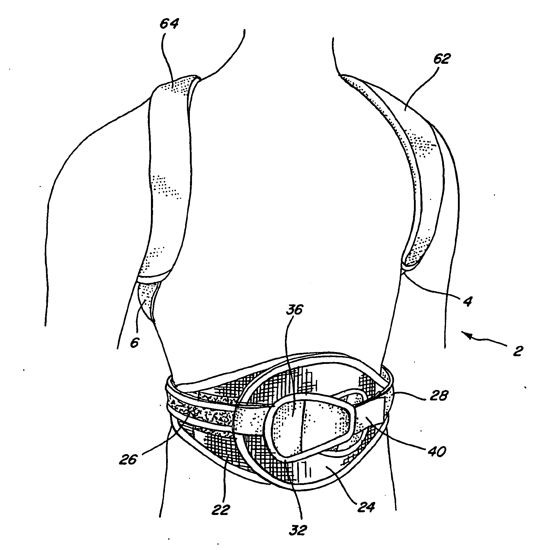 Adjustable posterior spinal orthosis