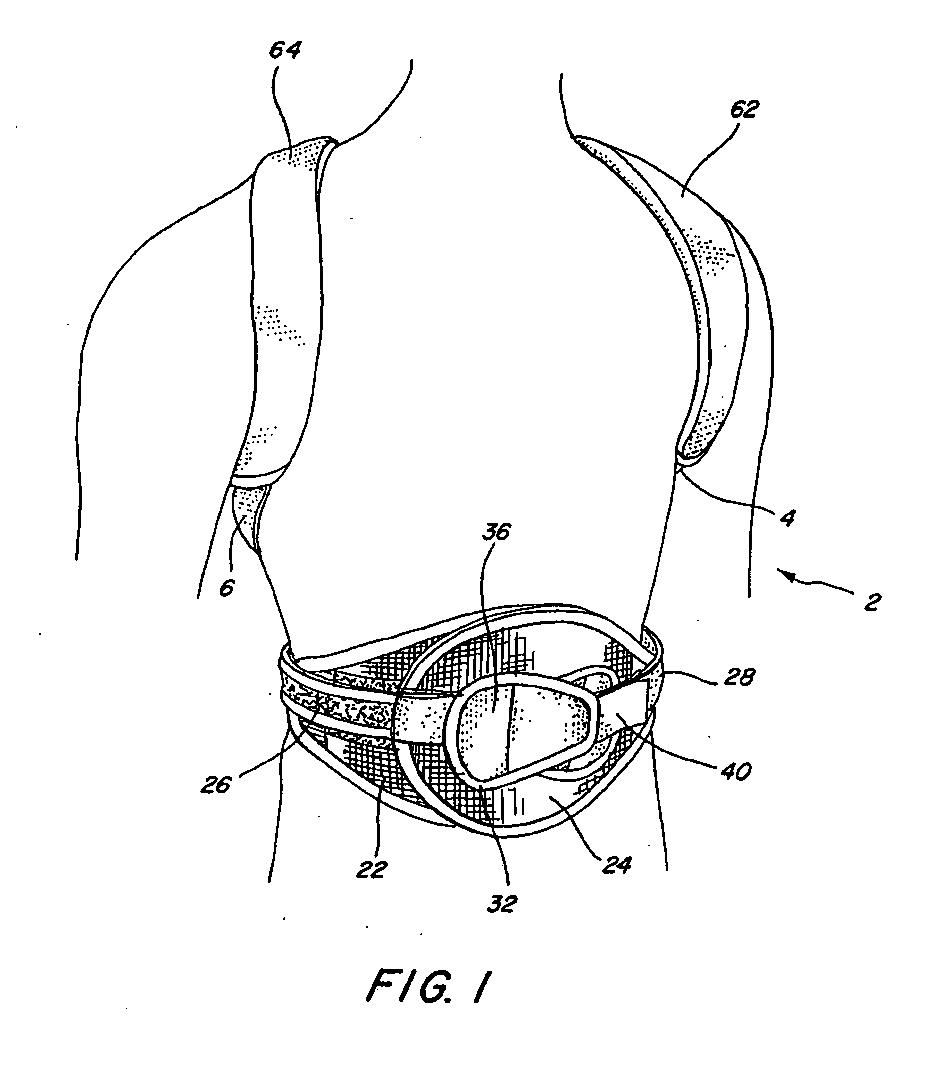 Adjustable posterior spinal orthosis