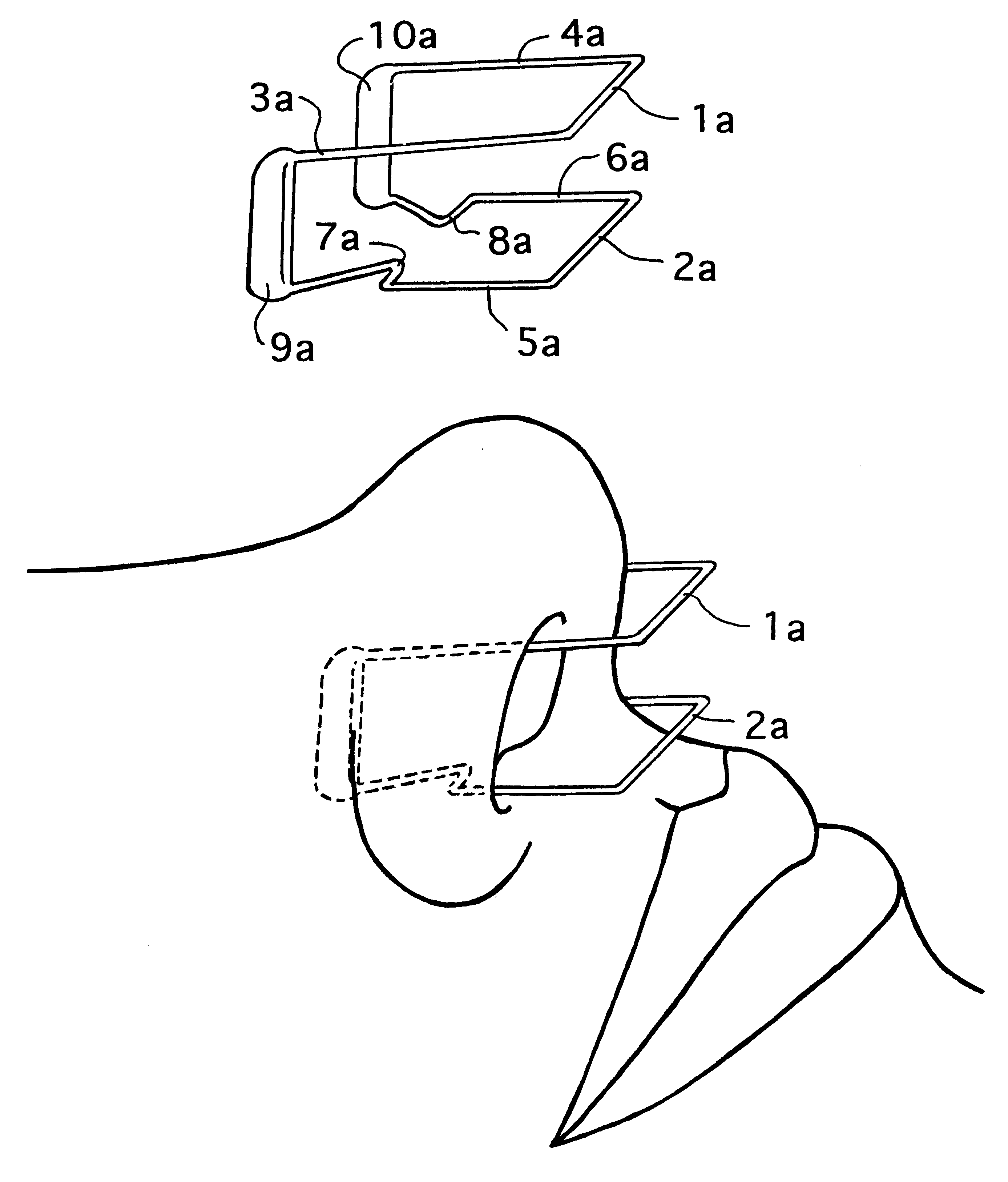 Internal nasal dilator