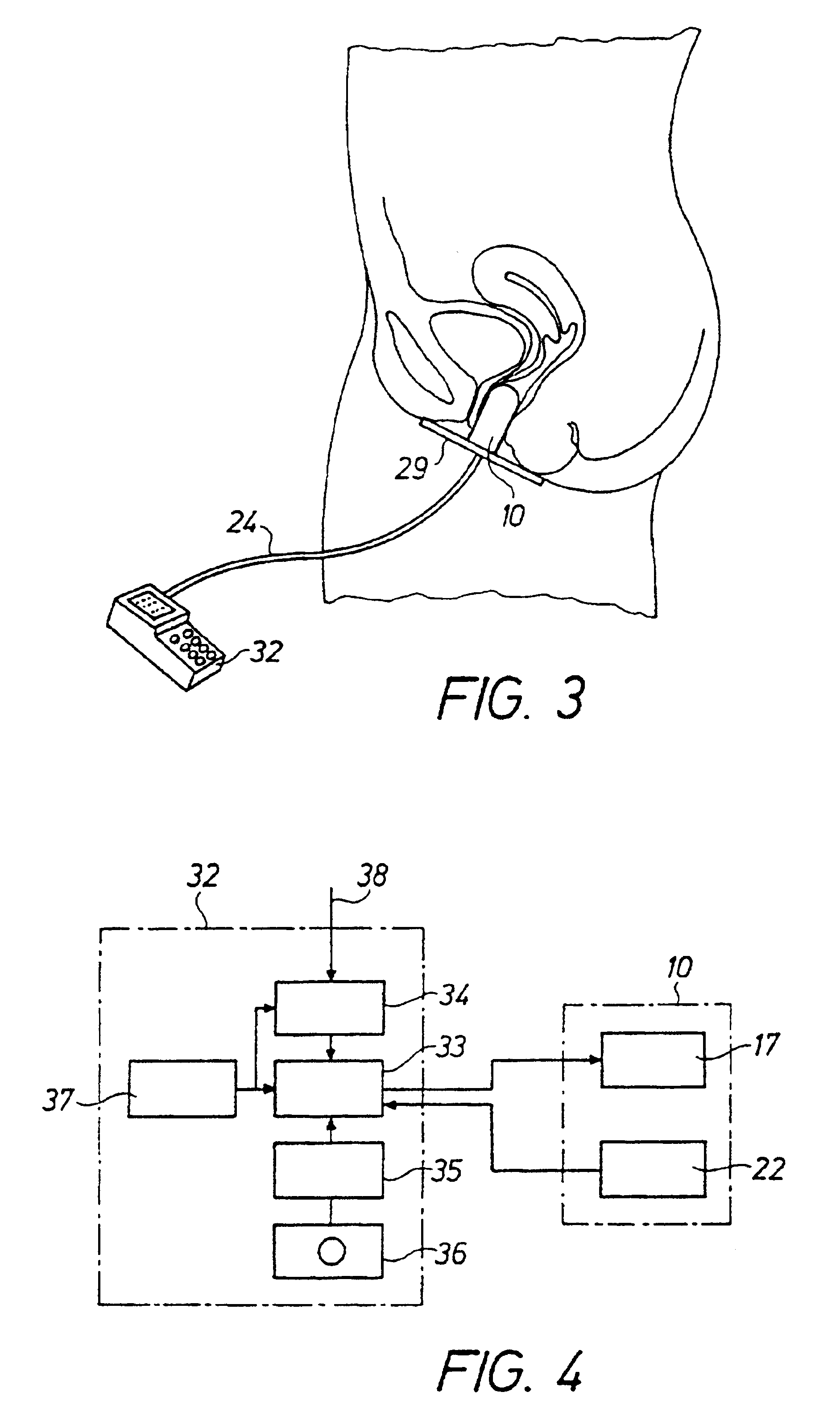 Method and device for training pelvic floor muscles