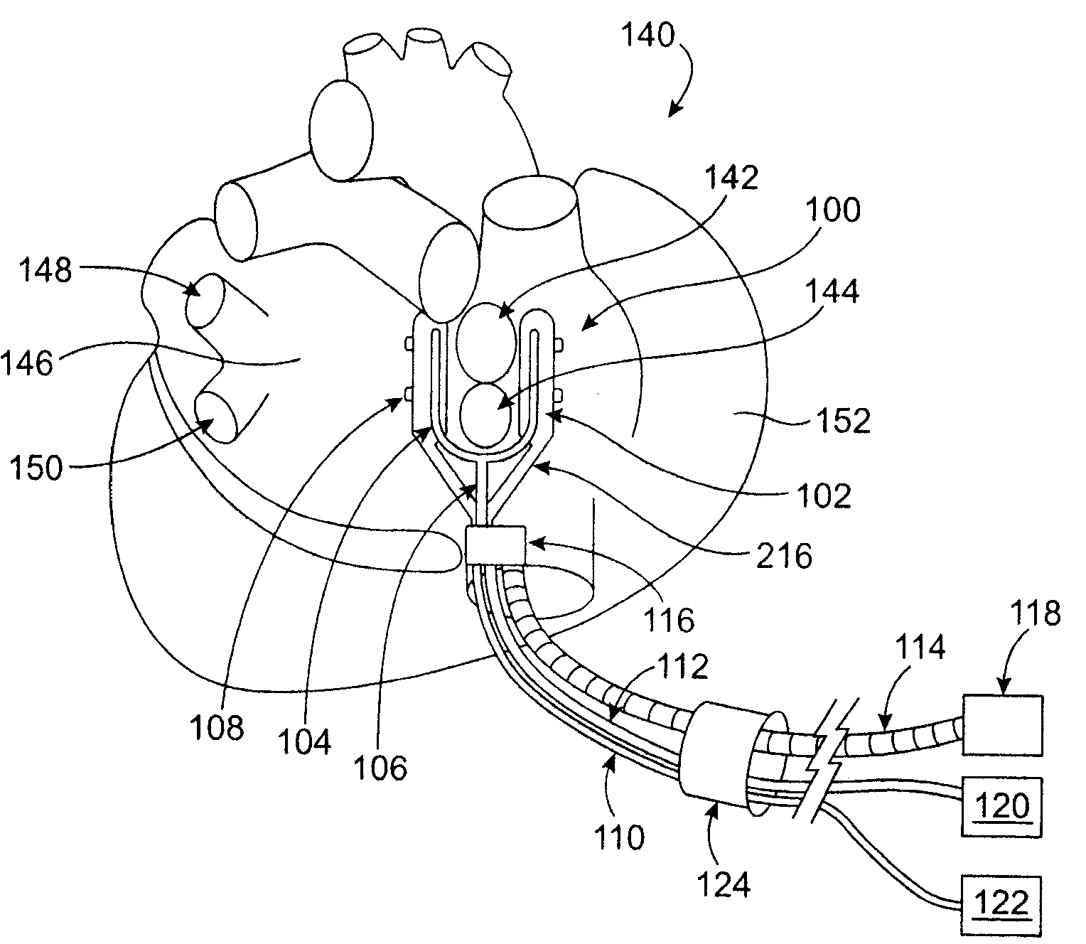 Cardiac ablation devices and methods