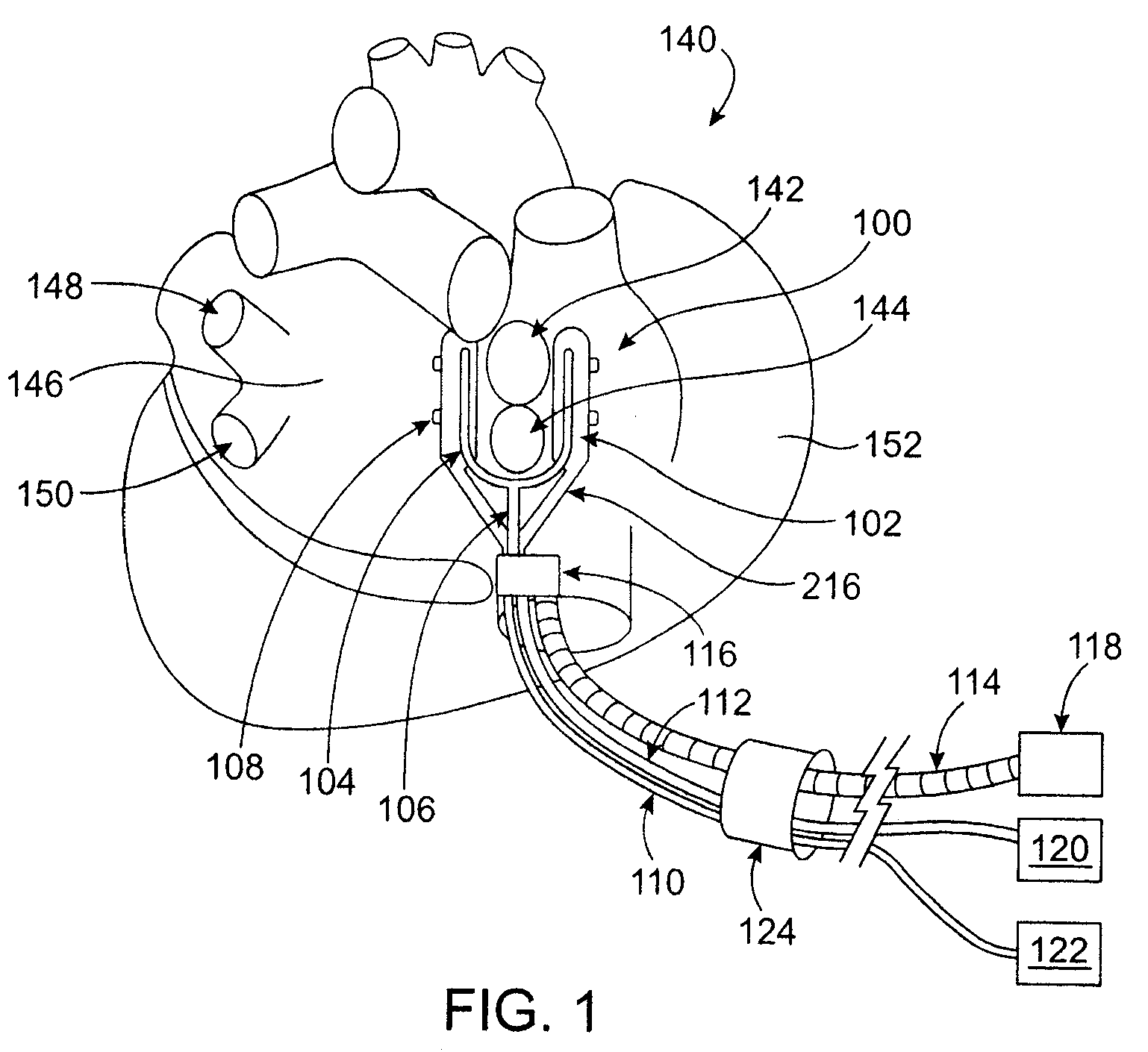 Cardiac ablation devices and methods