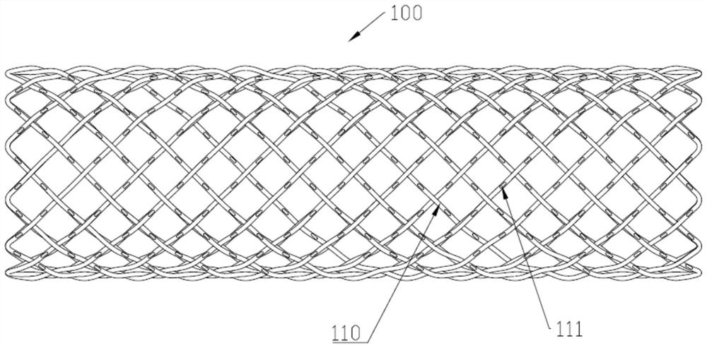 Weaved stent and woven stent system