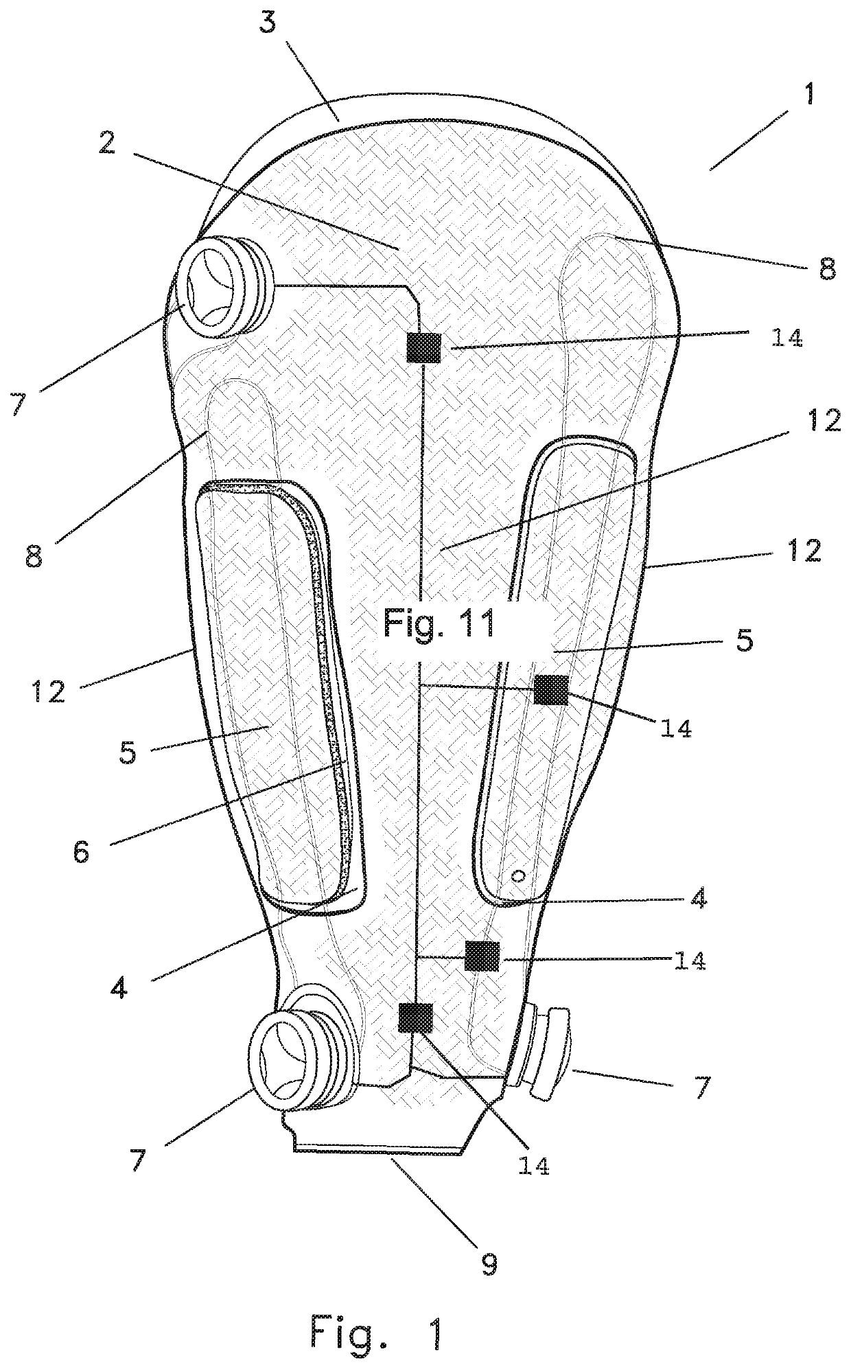 Disarticulated Compression Socket