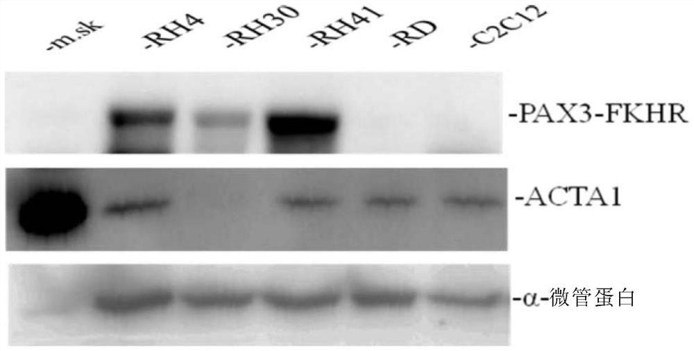 Application of pax3-fkhr and acta1 gene in prevention and treatment of rhabdomyosarcoma