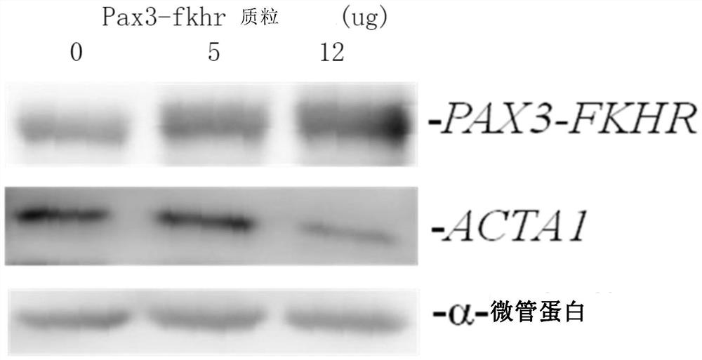 Application of pax3-fkhr and acta1 gene in prevention and treatment of rhabdomyosarcoma