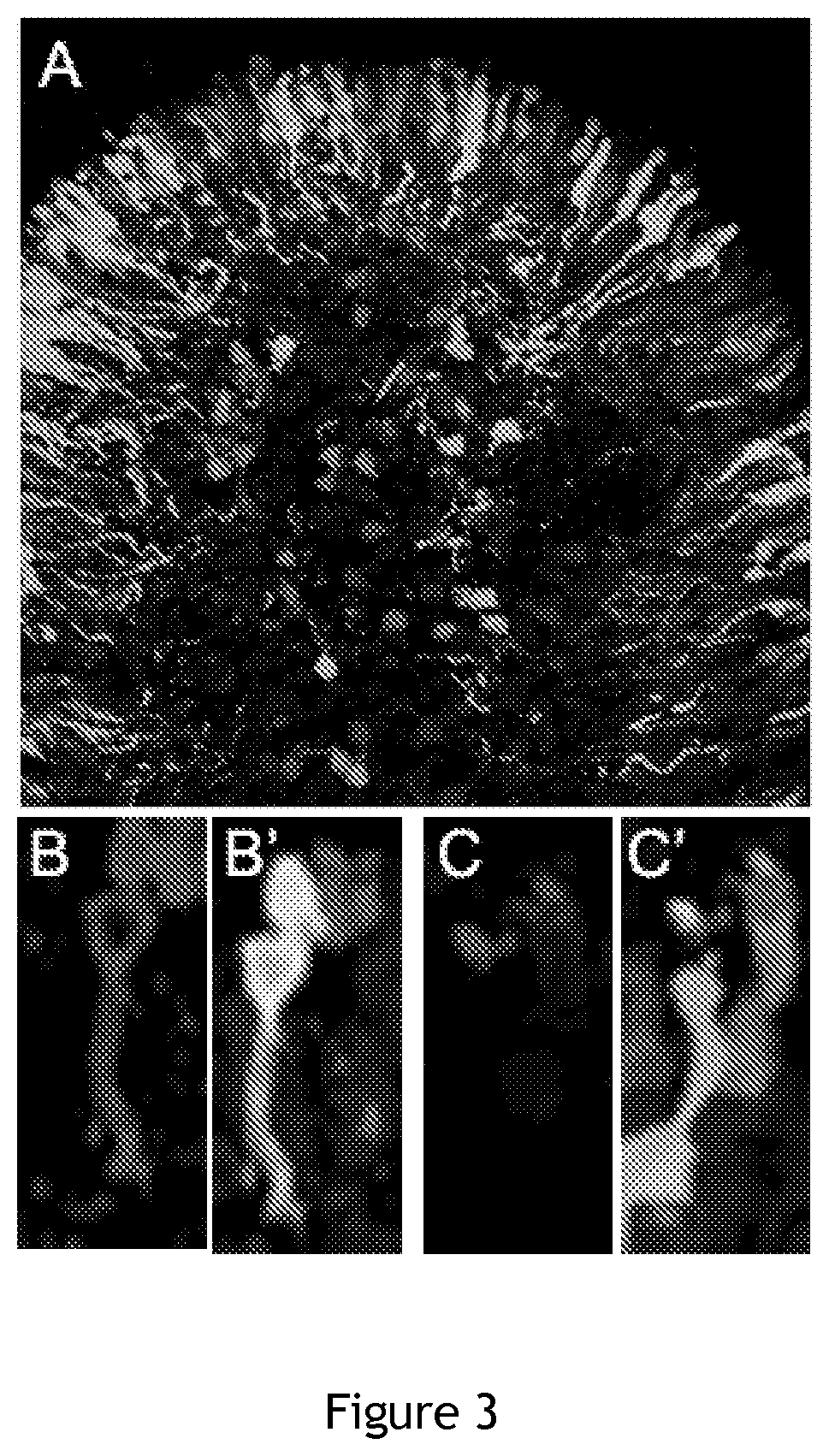 Compositions and Methods for Treating Retinal Disorders