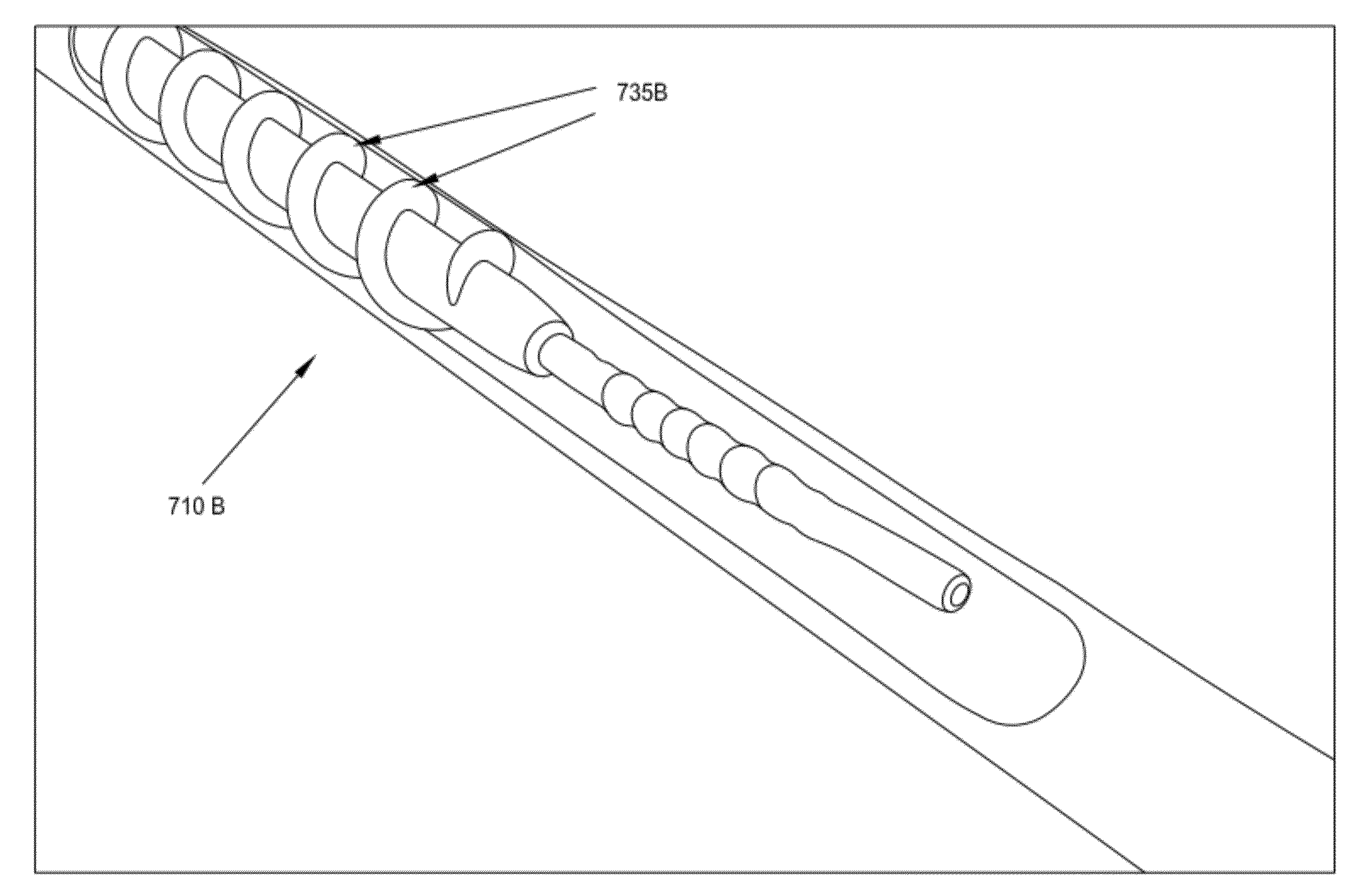 Rotate-to-advance catheterization system