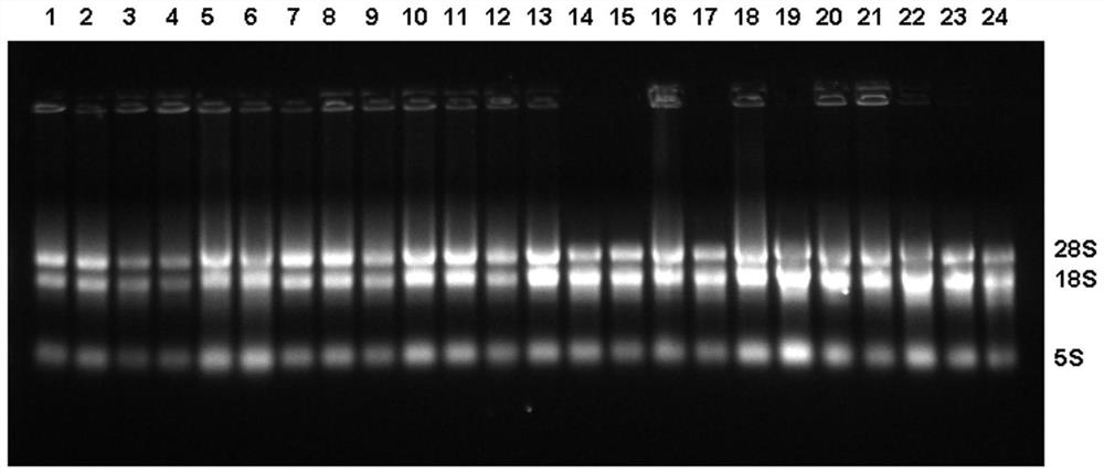 RT-PCR detection kit for GMBFV, PVY and GCLV viruses of garlic