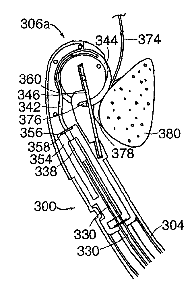 Suturing instruments and methods of use