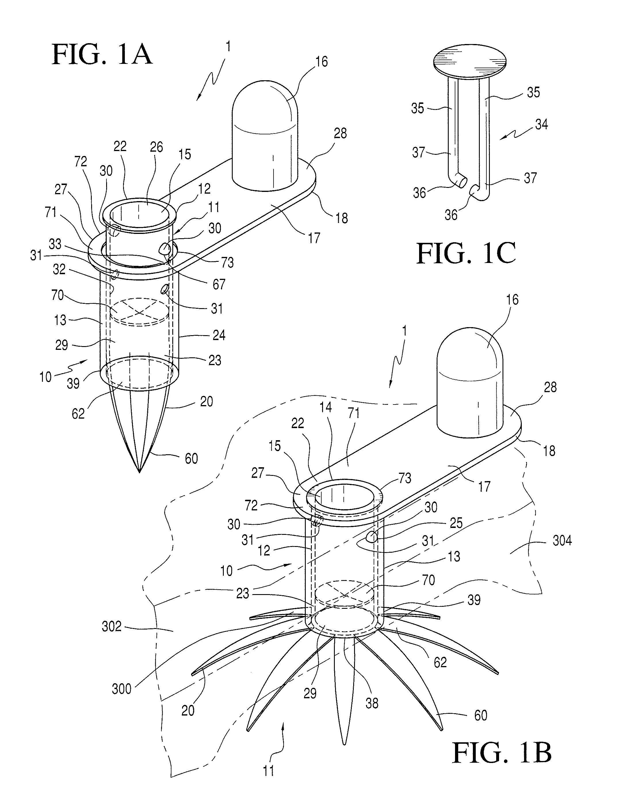 Retention device for gastrostomy tube and low profile gastrostomy device