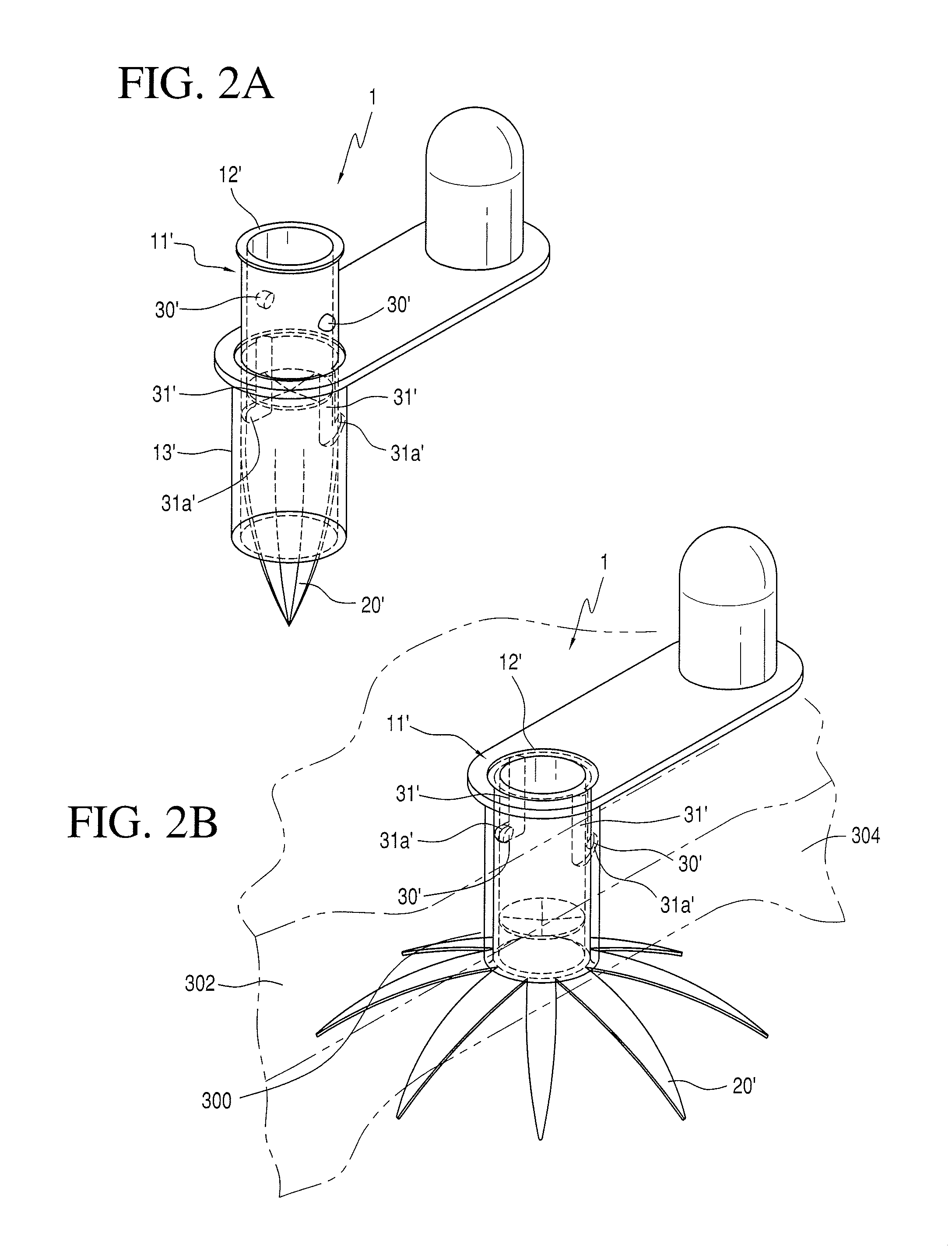 Retention device for gastrostomy tube and low profile gastrostomy device