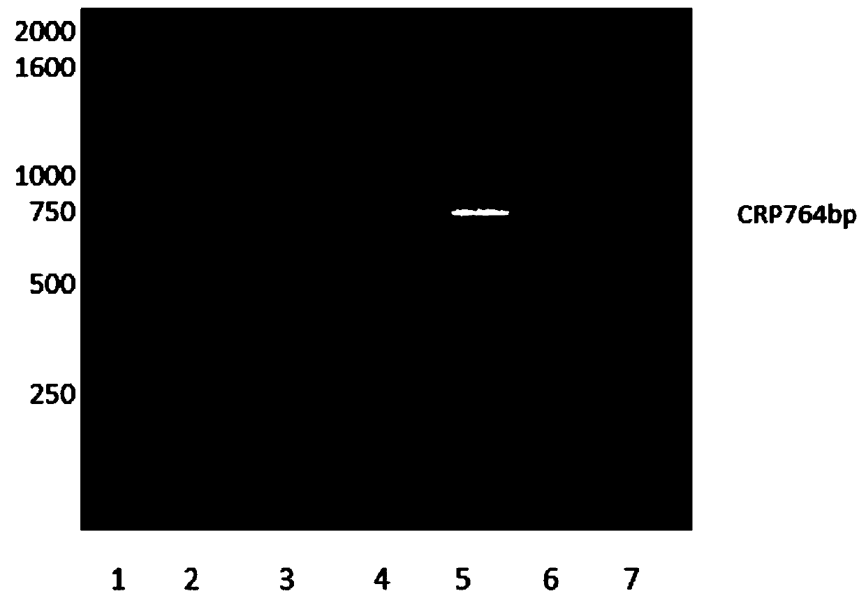 Preparation method of recombinant human C-reactive protein