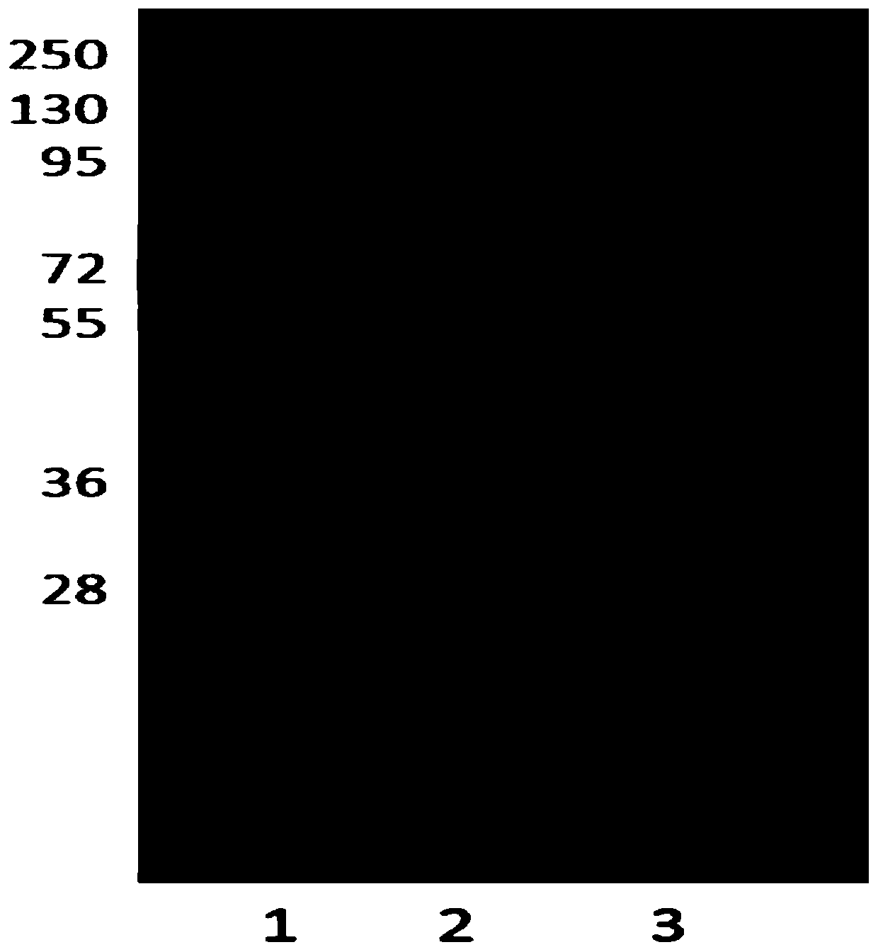 Preparation method of recombinant human C-reactive protein