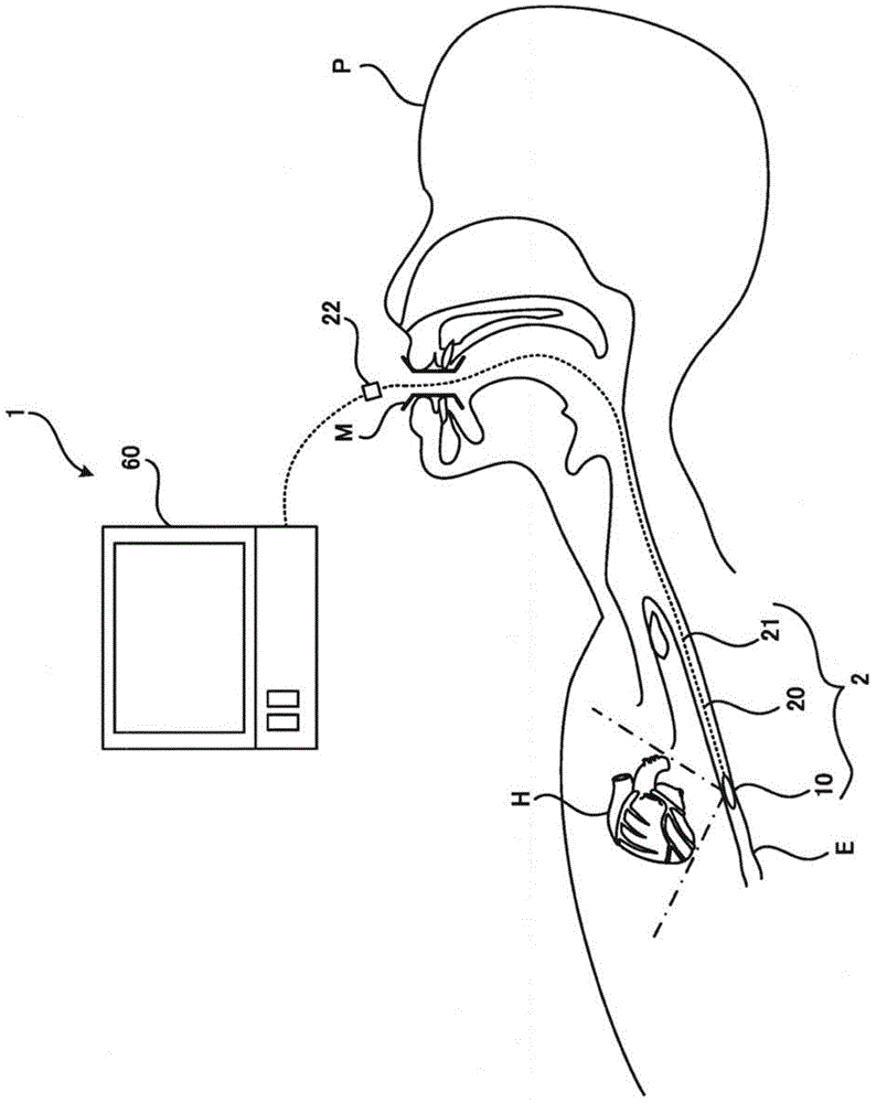Ultrasonic medical device, and ultrasonic image diagnostic device