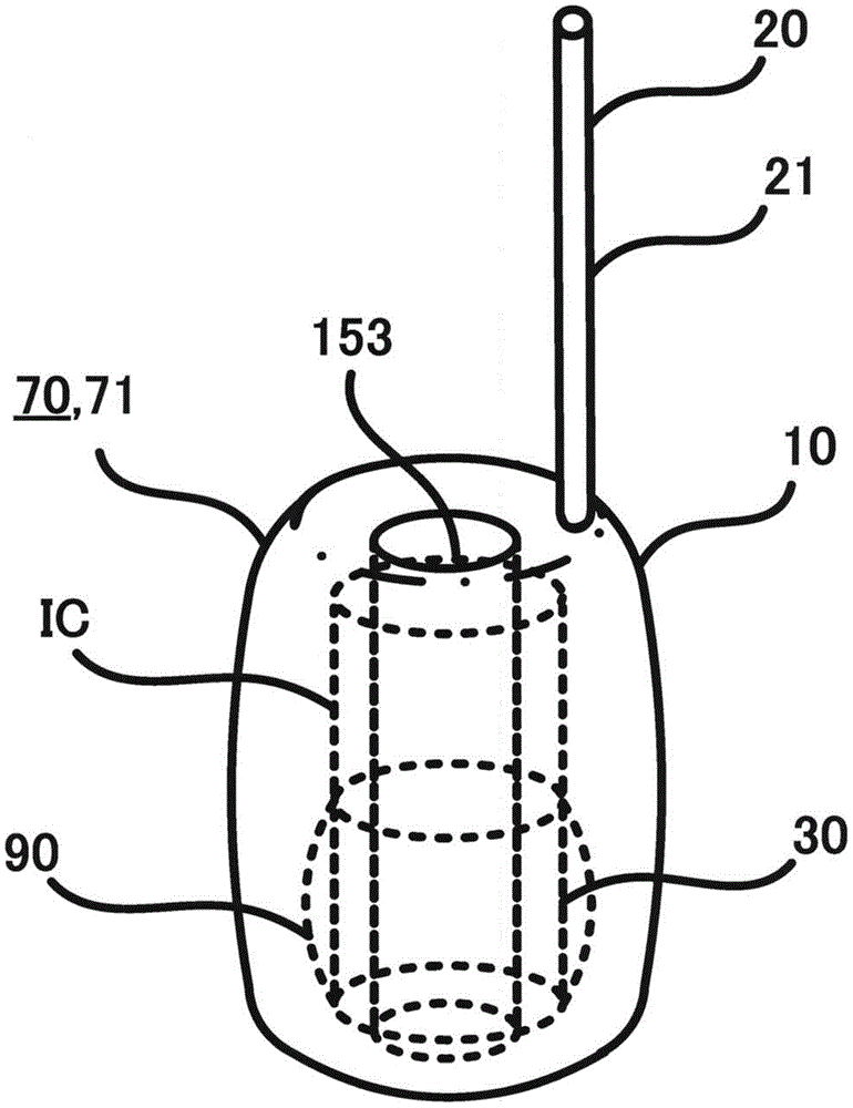 Ultrasonic medical device, and ultrasonic image diagnostic device