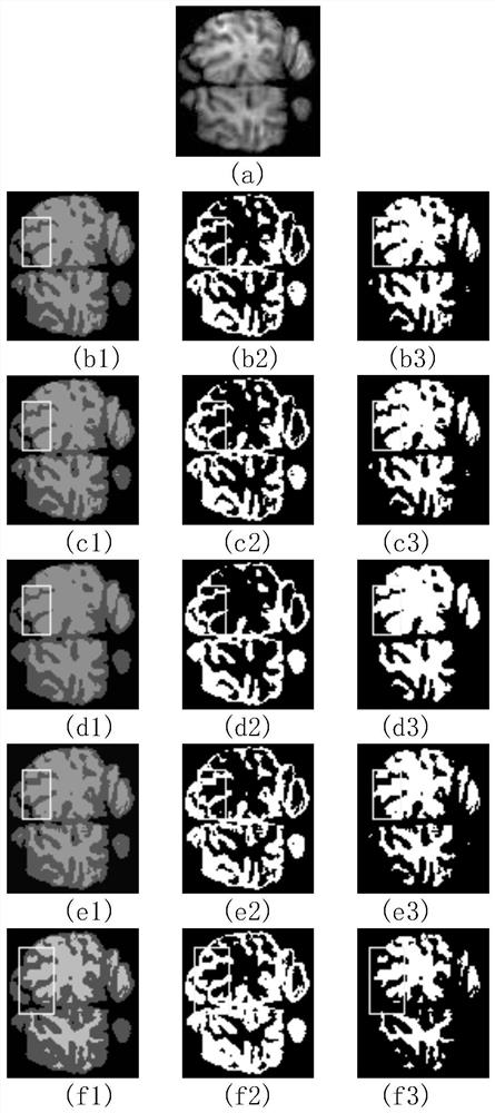 Brain magnetic resonance image segmentation method based on improved fuzzy C-means