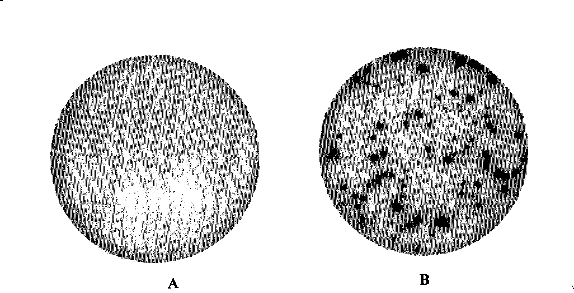 Reagent and method for detecting active tuberculosis and tuberculosis dormant infection