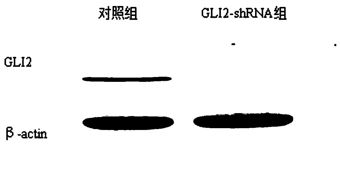 GLI2-shRNA and application thereof