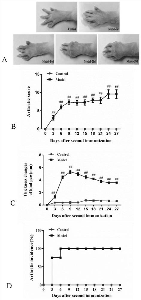 A diagnostic marker for bone destructive diseases and its application