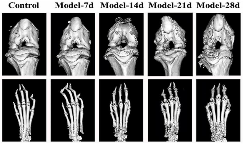 A diagnostic marker for bone destructive diseases and its application