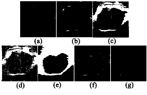 Method for constructing similarity matrix in ultrasound image Ncut segmentation process
