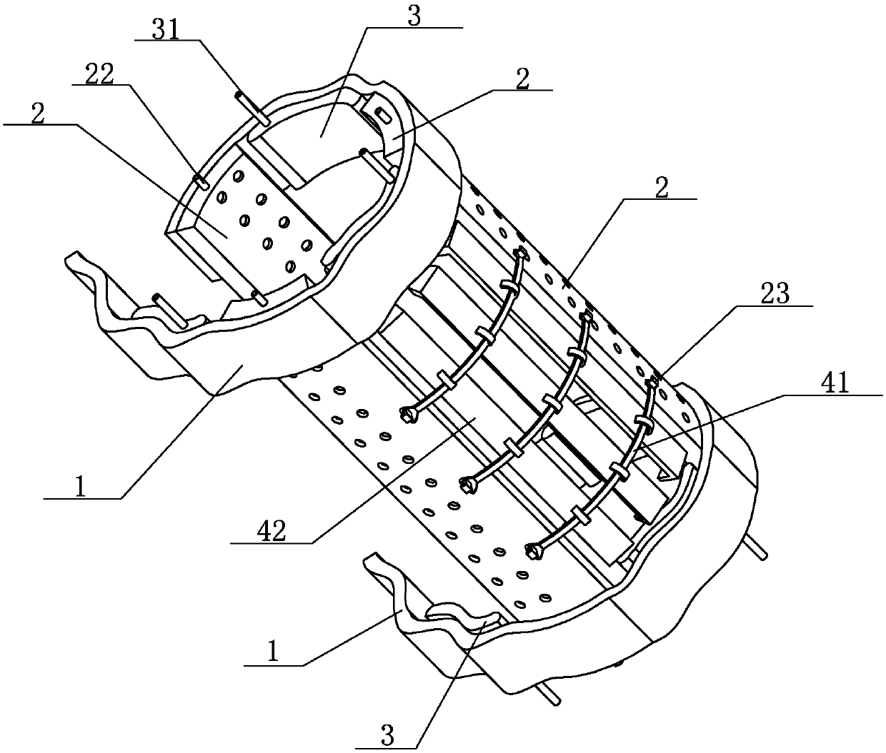 fracture fixation device