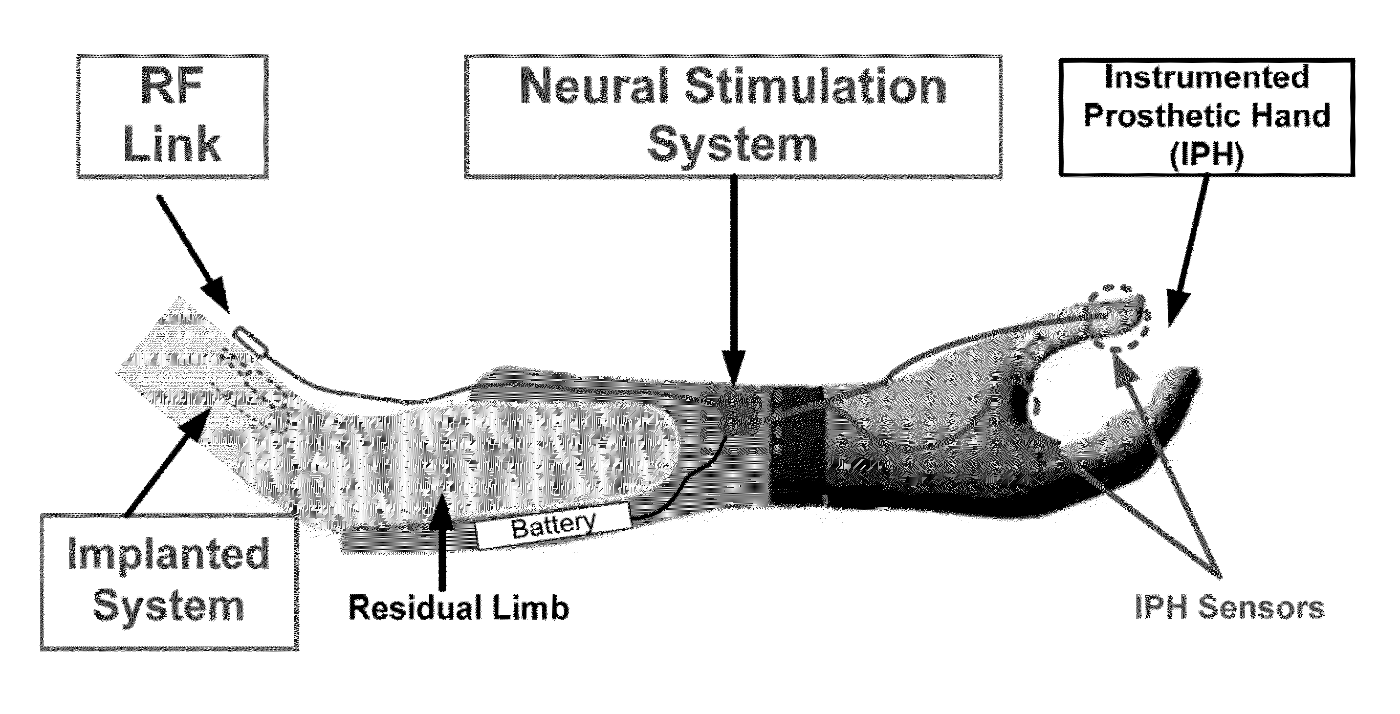 Fitting system for a neural enabled limb prosthesis system