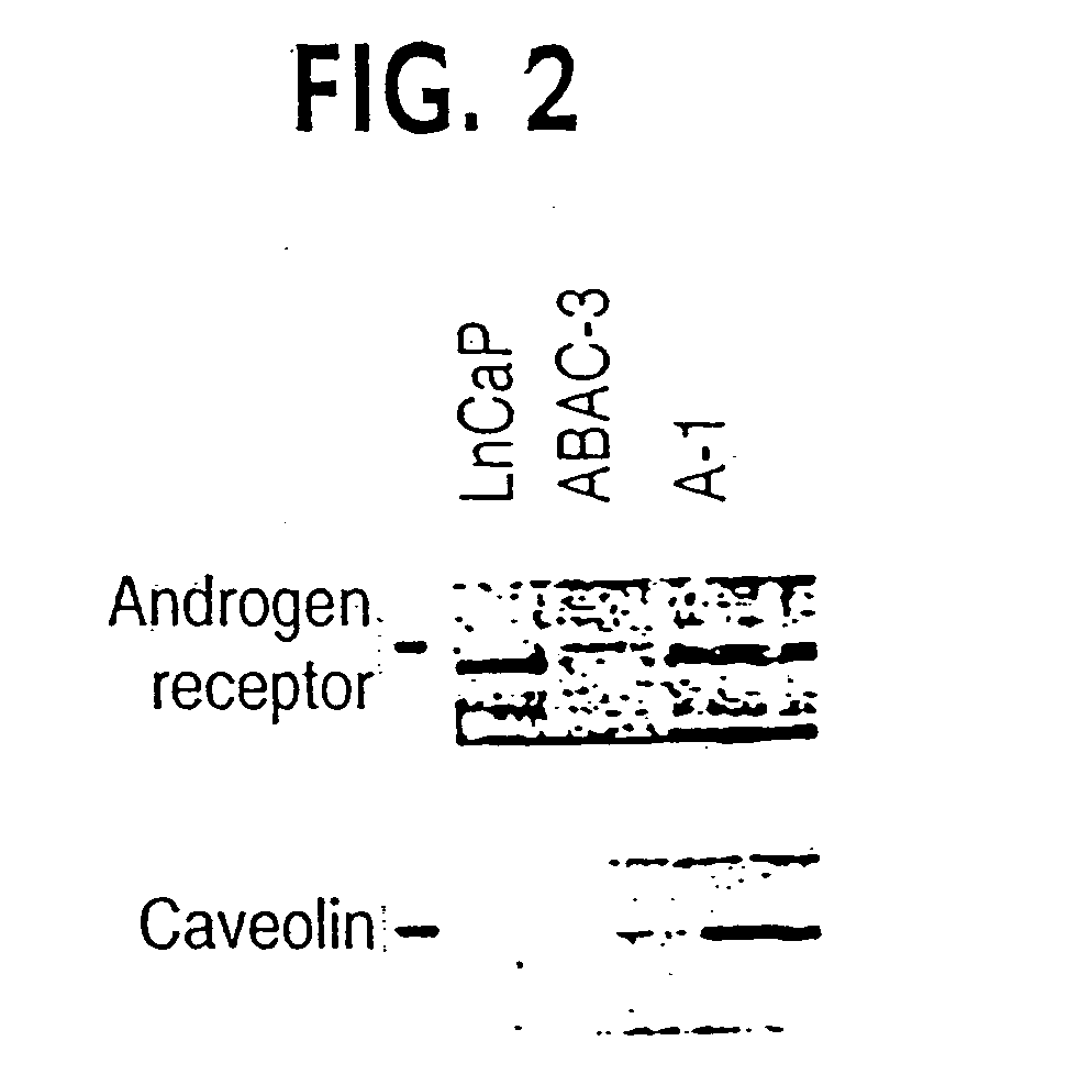 Methods for the treatment of neoplastic disorders with anti-caveolin agents