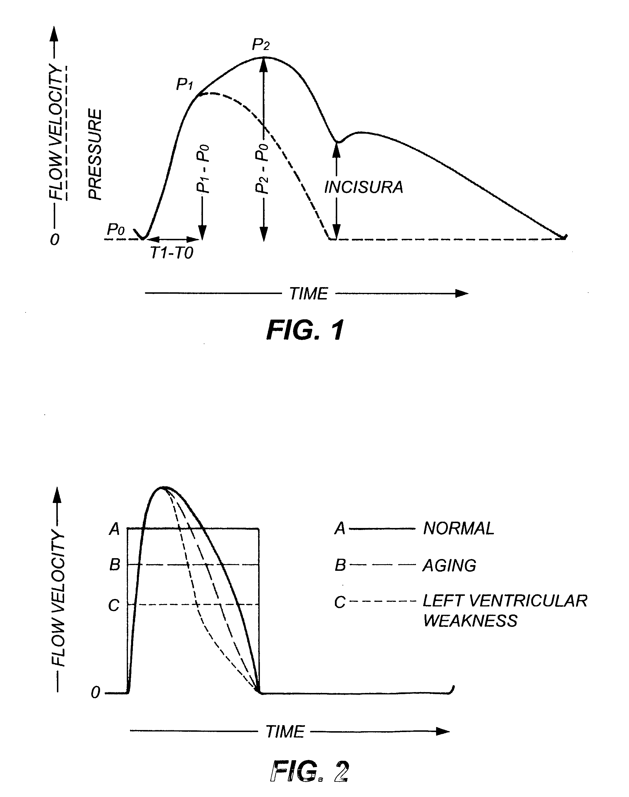 Method and apparatus for determination of cardiac output from the arterial pressure pulse waveform