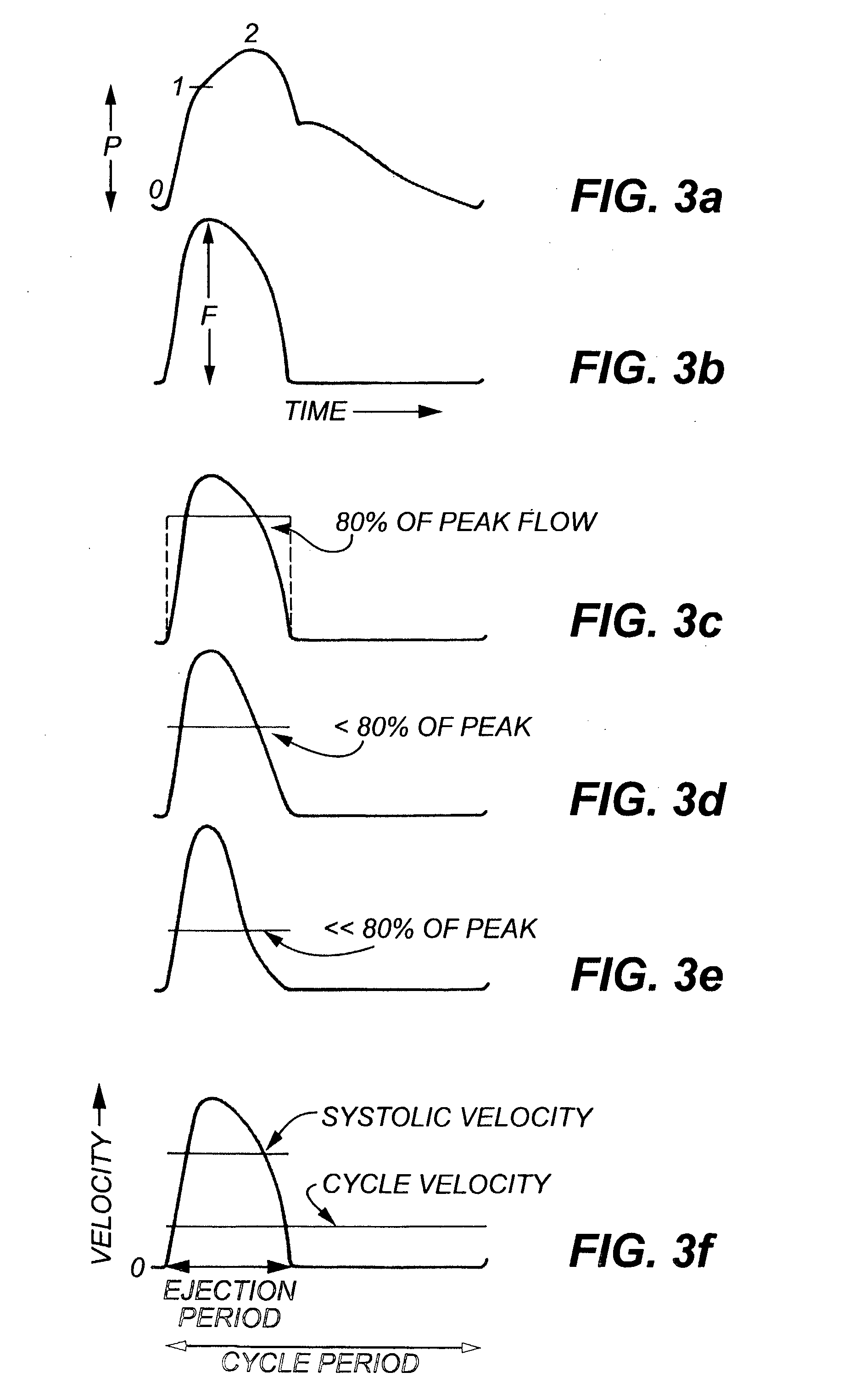 Method and apparatus for determination of cardiac output from the arterial pressure pulse waveform