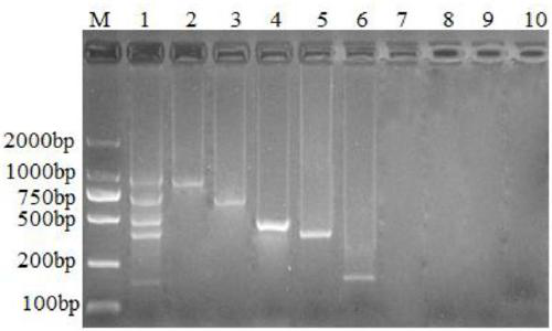 Method for simultaneously detecting multiple RT-PCR of GETV, PEDV, TGEV, PDCoV and PoRV