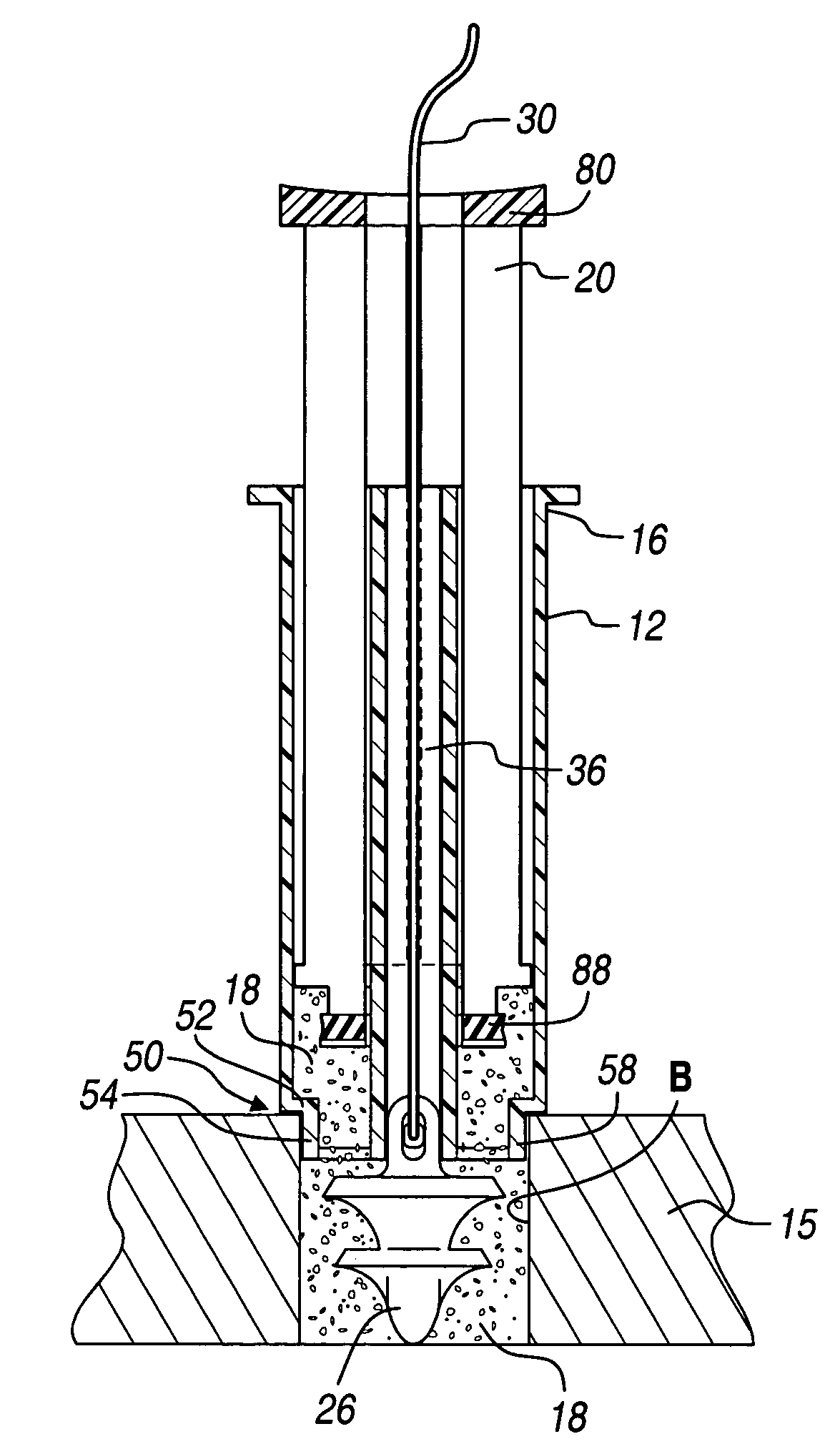 Method and apparatus for implanting a suture anchor