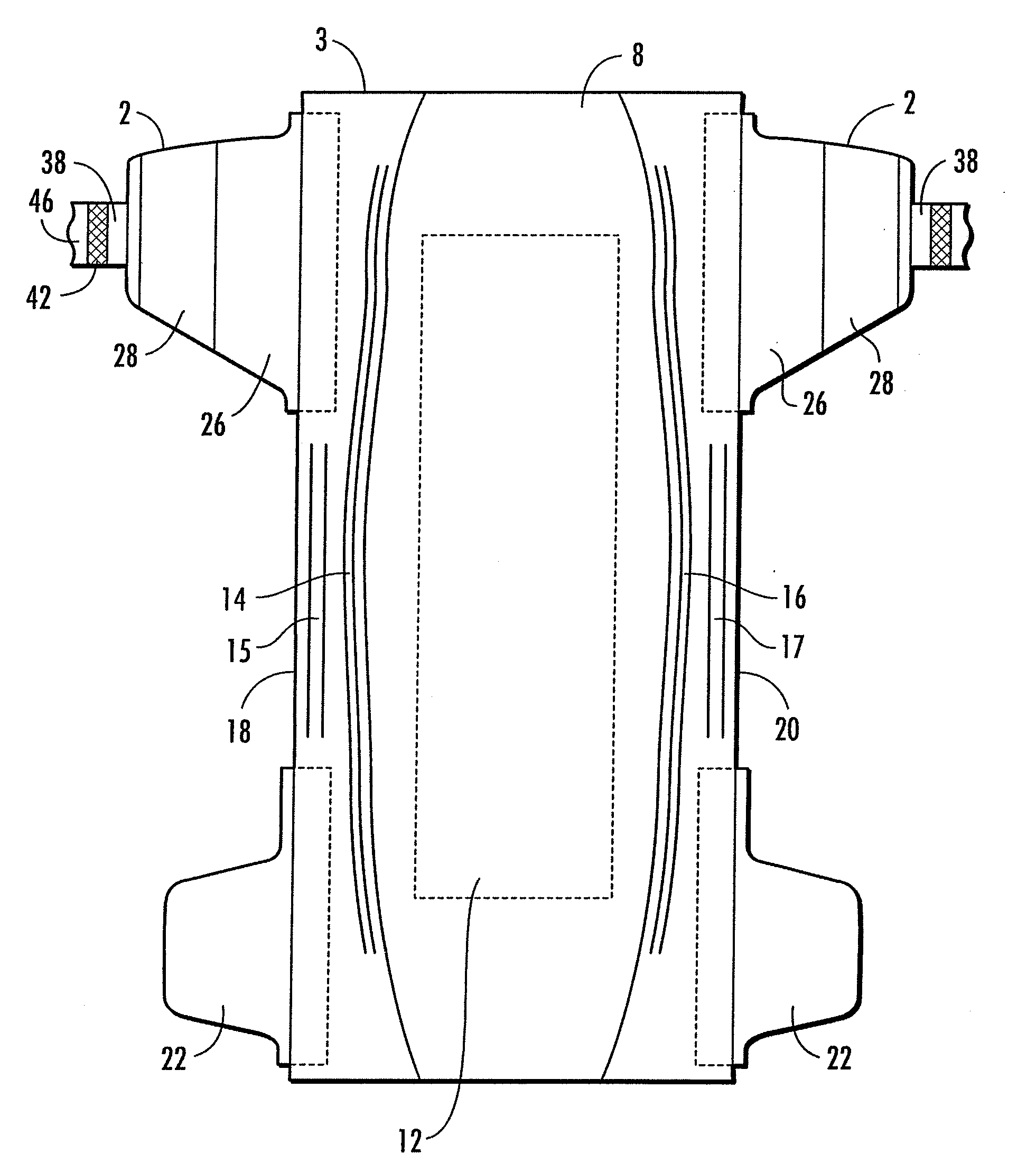 Hybrid stretch ear and absorbent article including the same