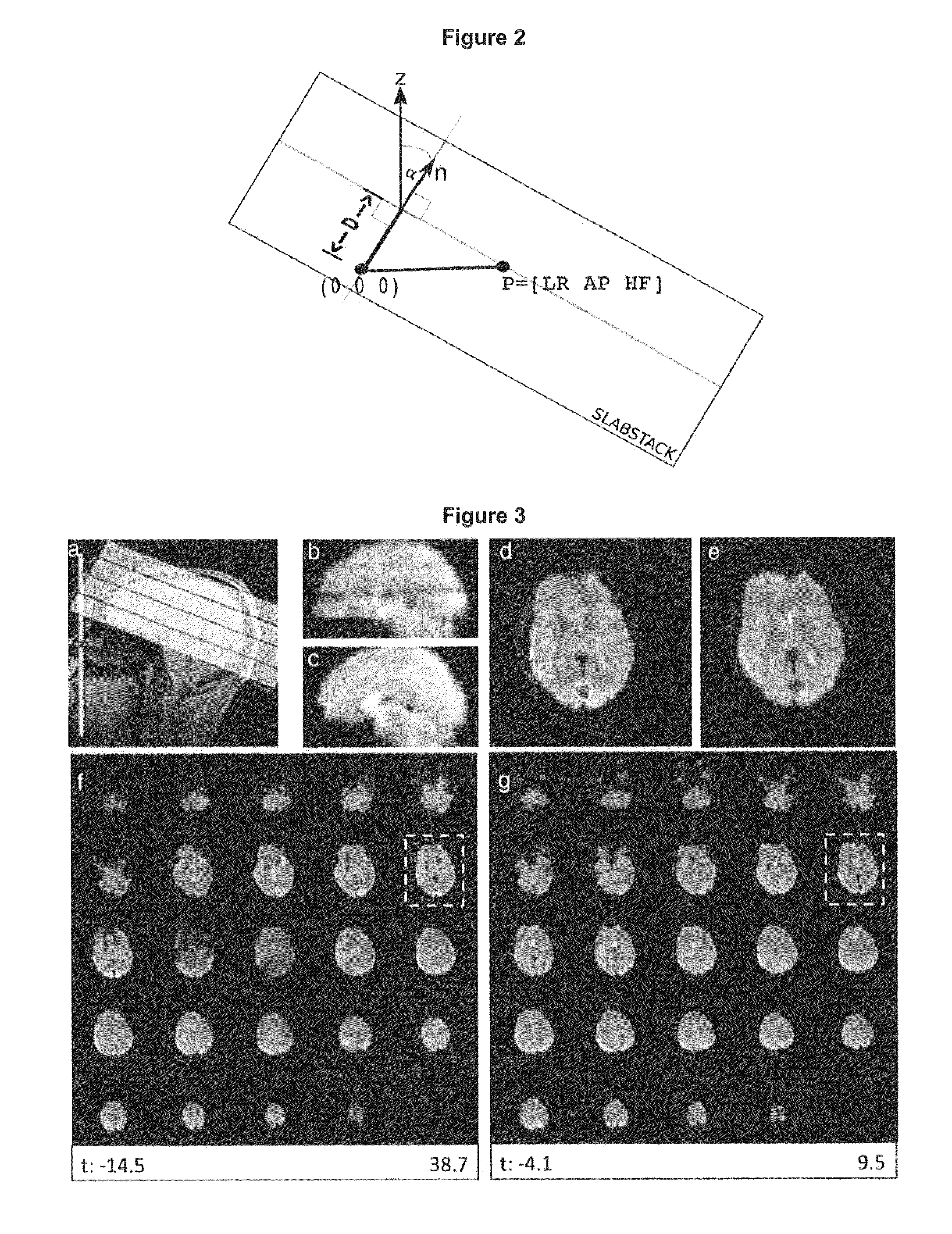 System and methods for improved real time functional magnetic resonance imaging