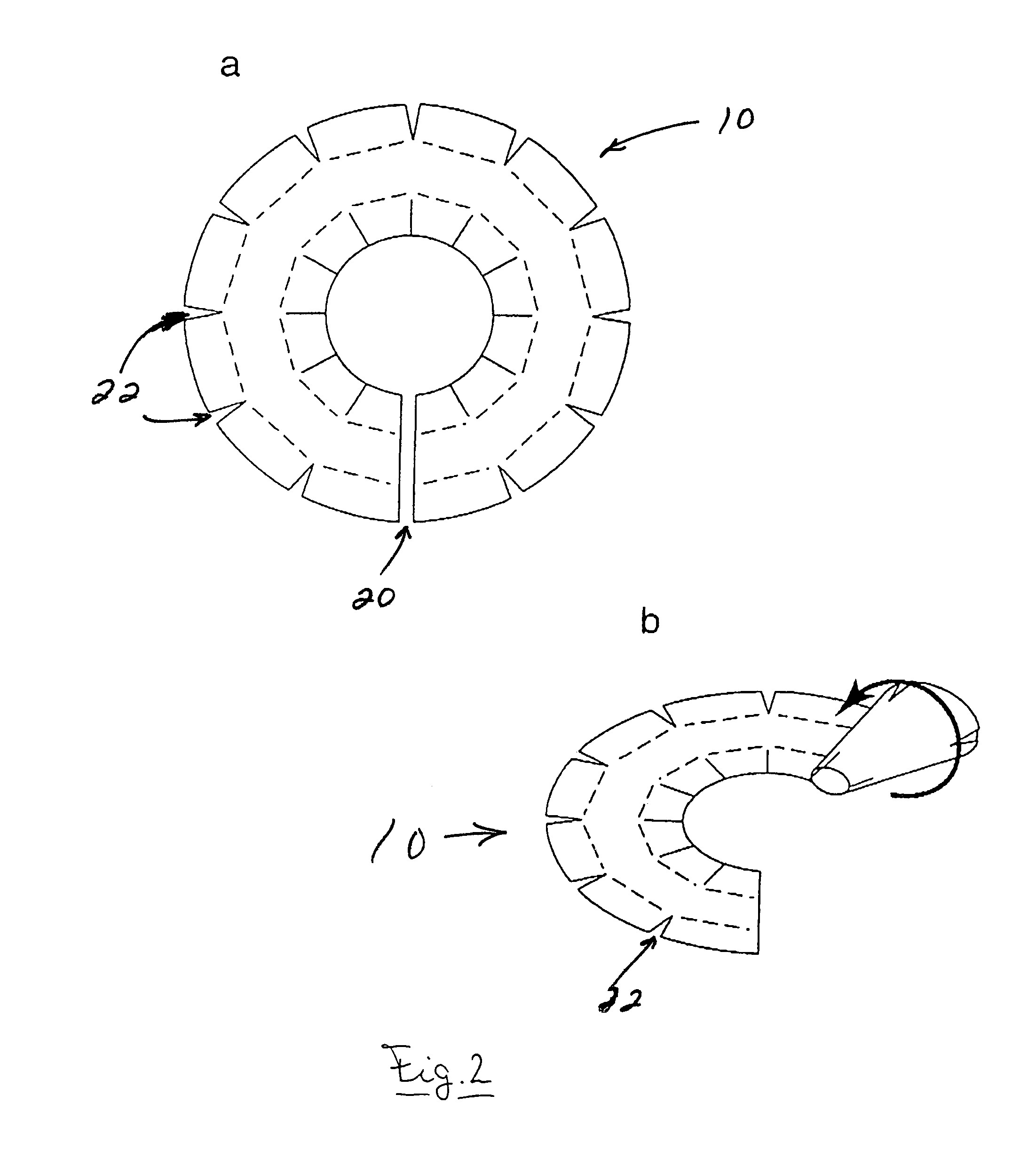 Microcontact structure for neuroprostheses for implantation on nerve tissue and method therefor