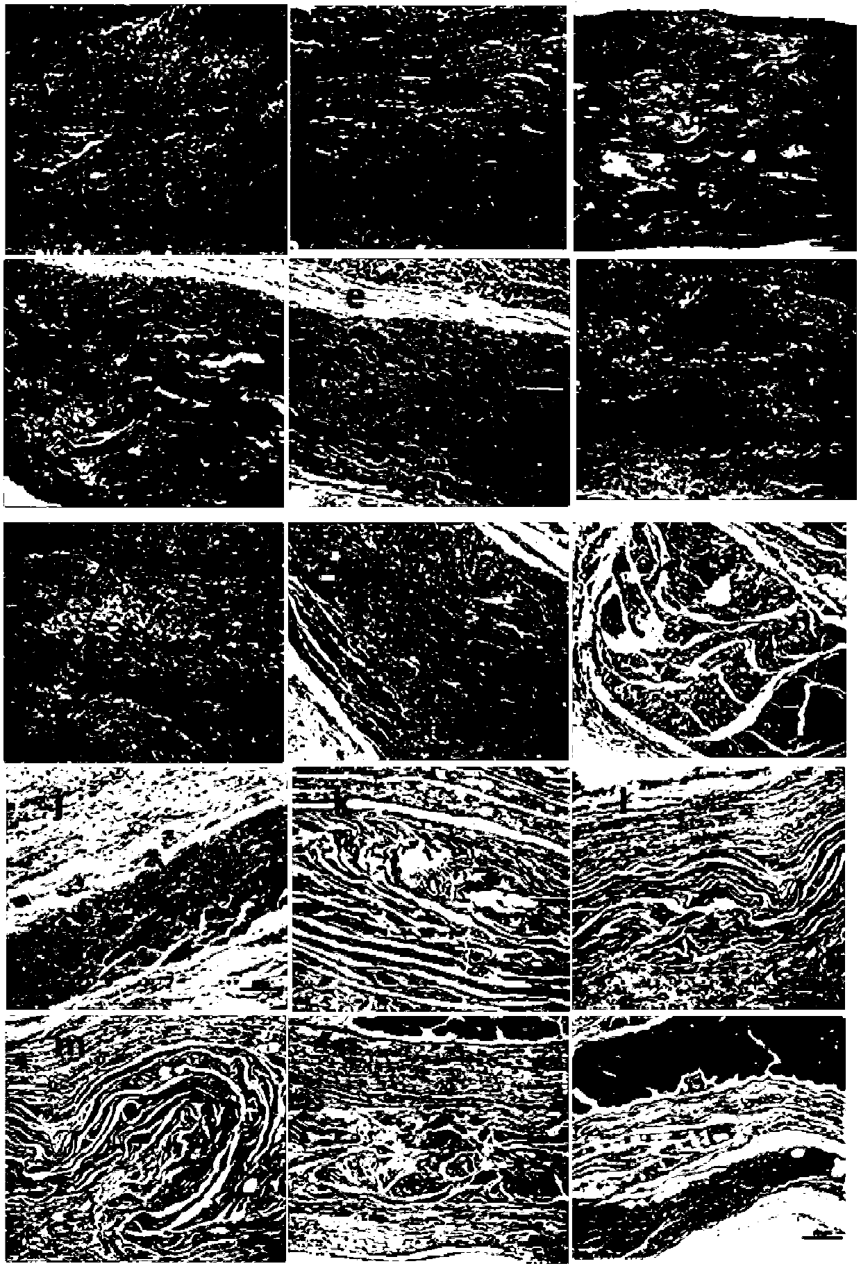 Preparation method and use of decellularized tendon material