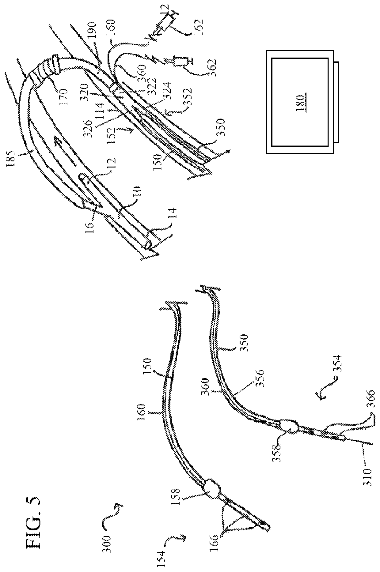 Unitary body systems and devices and methods to use the same for retroperfusion