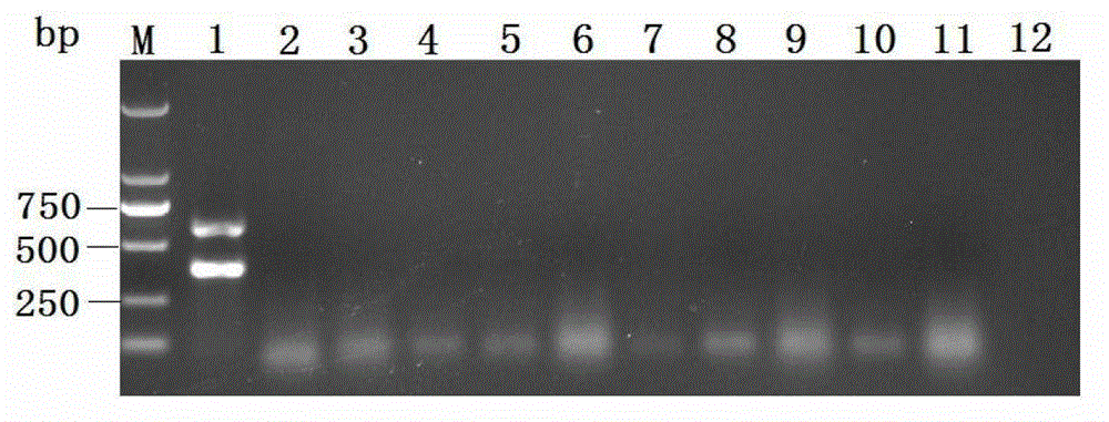 Duplex polymerase chain reaction (PCR) detection primer group, kit and method for pathogenic channa source aeromonas schubertii