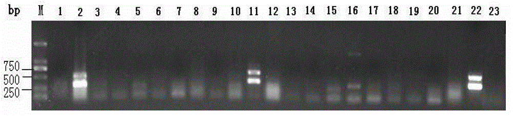 Duplex polymerase chain reaction (PCR) detection primer group, kit and method for pathogenic channa source aeromonas schubertii
