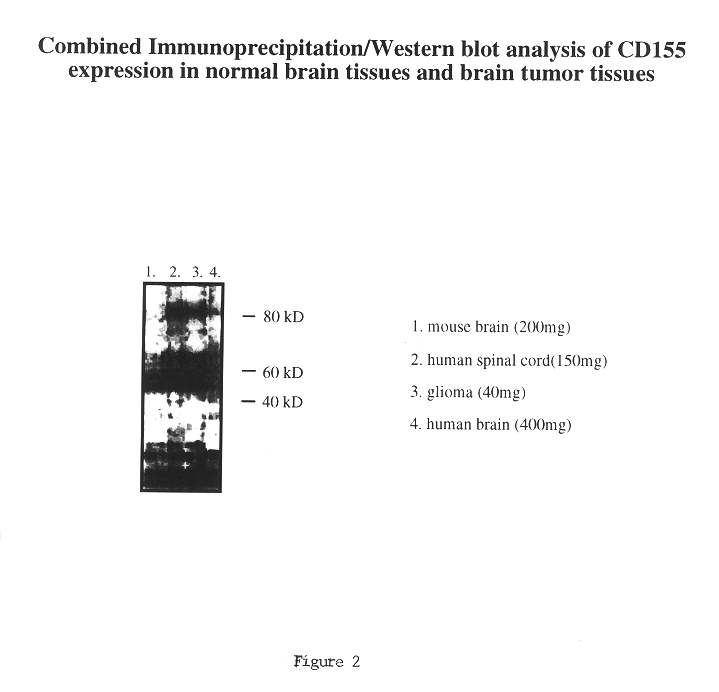 Method of detecting the presence of CD155 for diagnosis of cancer and to determine treatment