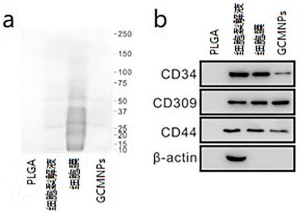 Anti-cancer nano-drug with immune activation function and preparation method thereof