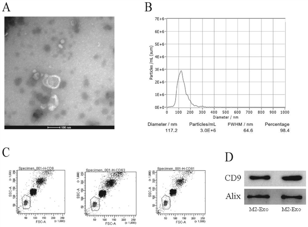 Macrophage-derived exosome preparation for resisting inflammation and promoting tissue regeneration and preparation method and application of macrophage-derived exosome preparation
