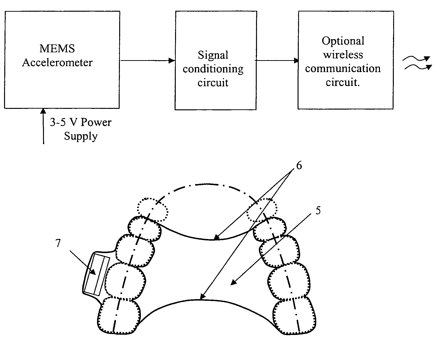 Method and apparatus for tooth bone conduction microphone