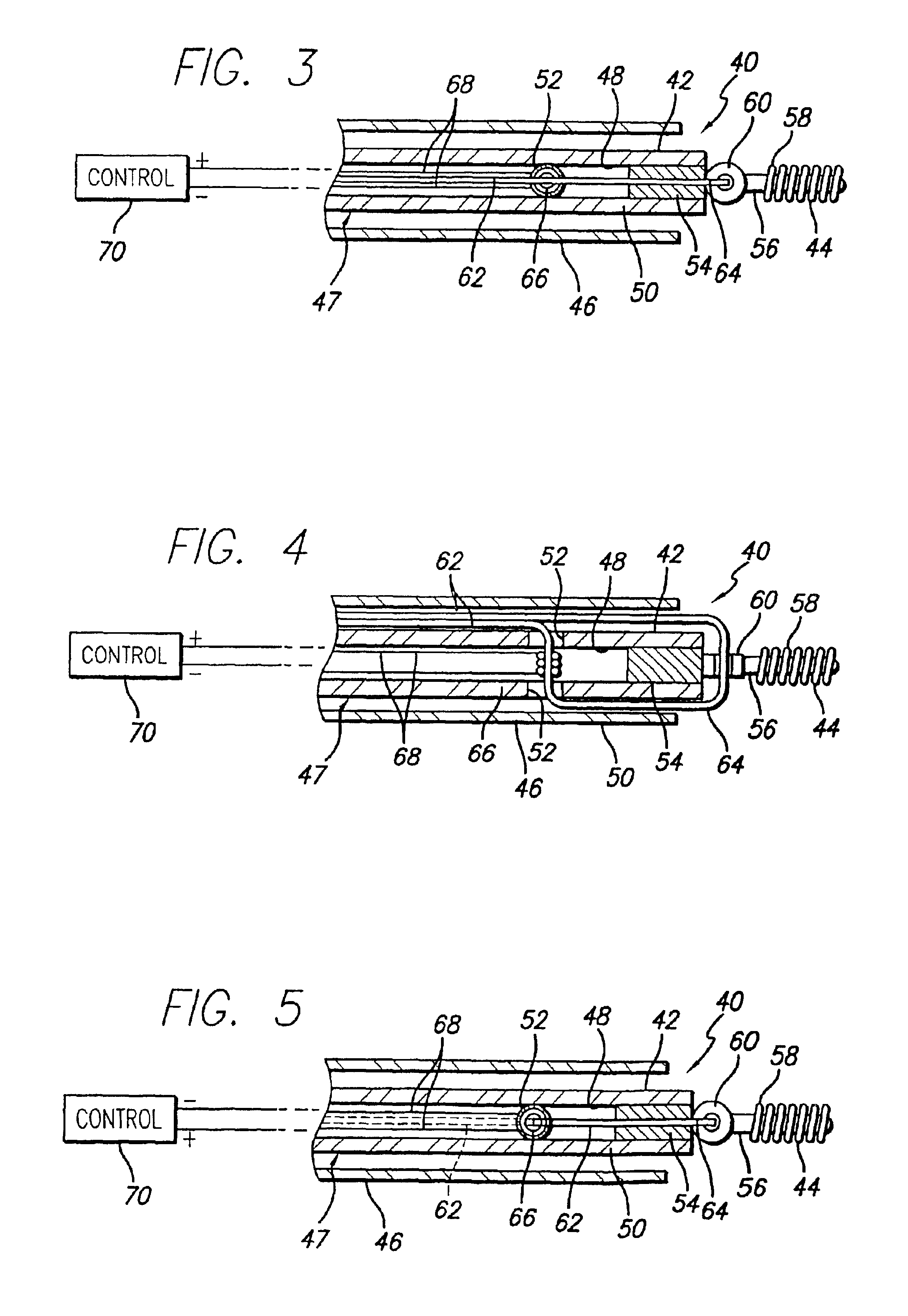Apparatus for deployment of micro-coil using a catheter