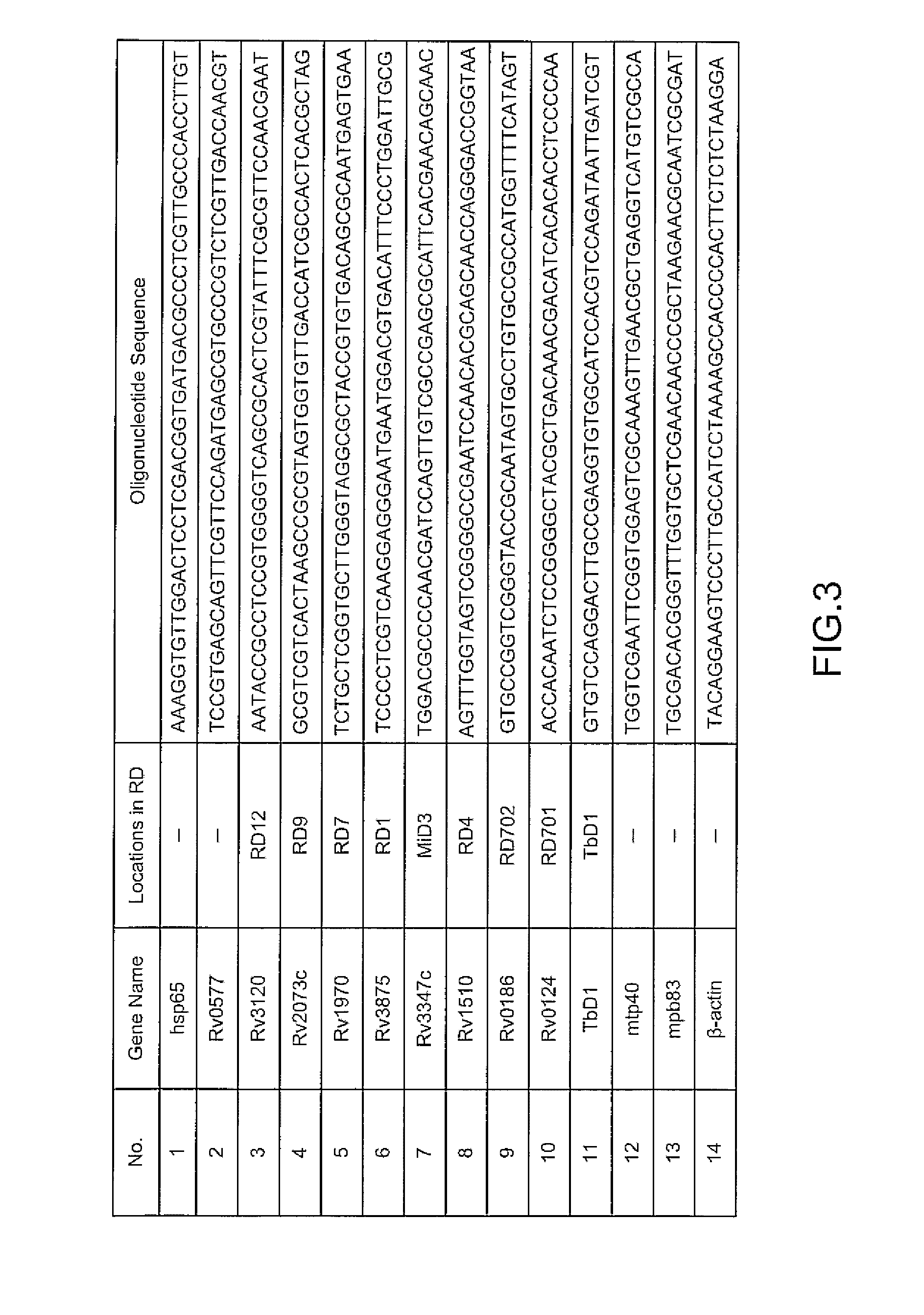 Method of Diagnosing Active Mycobacterium Tuberculosis with Detecting Chip