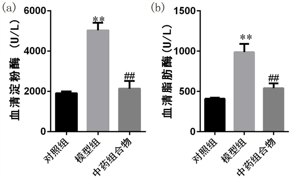 Traditional Chinese medicine composition for treating acute pancreatitis and application thereof